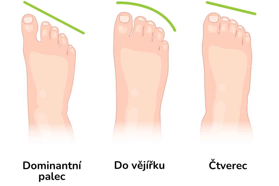 Typy chodidel - palce